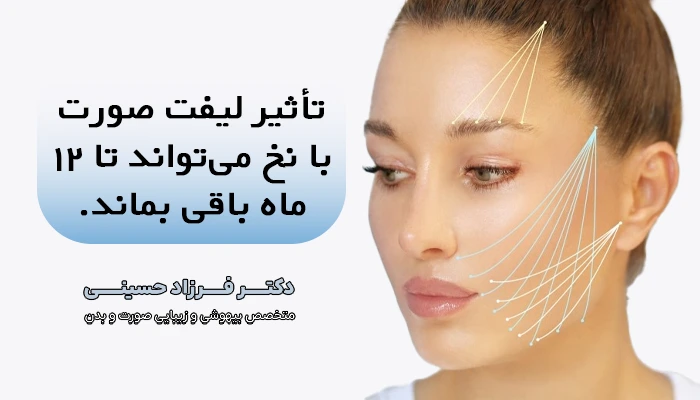 تأثیر لیفت صورت با نخ