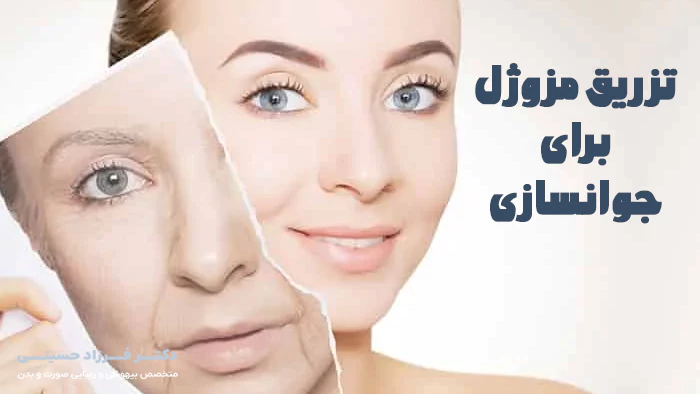 تزریق مزوژل برای جوانسازی