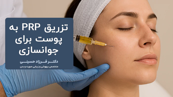 تزریق پی آرپی پوست