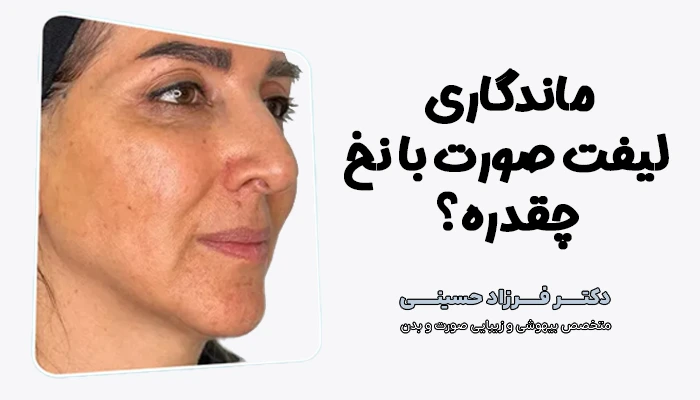 ماندگاری لیفت صورت با نخ چقدره