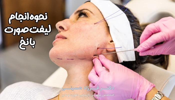 نحوه انجام لیفت صورت با نح