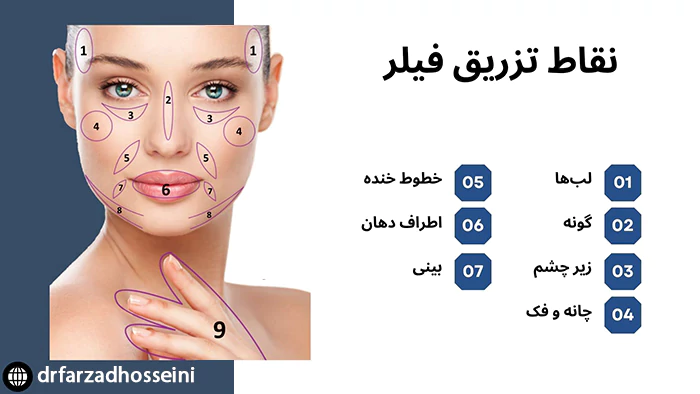 نواحی تزریق فیلر