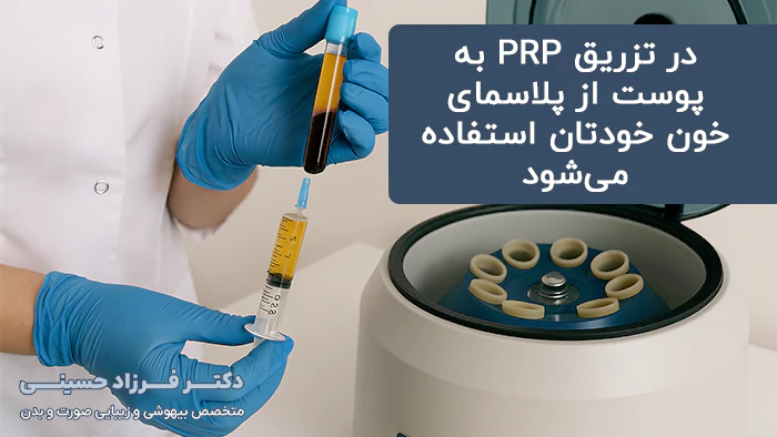 پی آرپی پوست